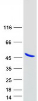 ANKRD2 Protein - Purified recombinant protein ANKRD2 was analyzed by SDS-PAGE gel and Coomassie Blue Staining