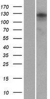 ANKRD24 Protein - Western validation with an anti-DDK antibody * L: Control HEK293 lysate R: Over-expression lysate