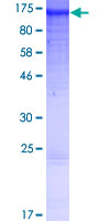 ANKRD27 Protein - 12.5% SDS-PAGE of human ANKRD27 stained with Coomassie Blue