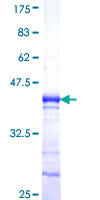 ANKRD30A / NY-BR-1 Protein - 12.5% SDS-PAGE Stained with Coomassie Blue.