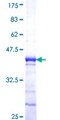 ANKRD30A / NY-BR-1 Protein - 12.5% SDS-PAGE Stained with Coomassie Blue.