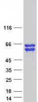 ANKRD34A Protein - Purified recombinant protein ANKRD34A was analyzed by SDS-PAGE gel and Coomassie Blue Staining