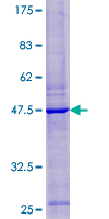 ANKRD36 Protein - 12.5% SDS-PAGE of human ANKRD36 stained with Coomassie Blue