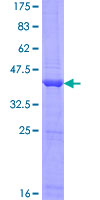 ANKRD37 Protein - 12.5% SDS-PAGE of human ANKRD37 stained with Coomassie Blue
