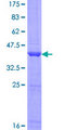 ANKRD37 Protein - 12.5% SDS-PAGE of human ANKRD37 stained with Coomassie Blue