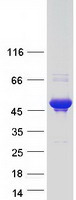 ANKRD40 Protein - Purified recombinant protein ANKRD40 was analyzed by SDS-PAGE gel and Coomassie Blue Staining