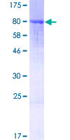 ANKRD44 Protein - 12.5% SDS-PAGE of human ANKRD44 stained with Coomassie Blue