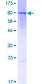 ANKRD44 Protein - 12.5% SDS-PAGE of human ANKRD44 stained with Coomassie Blue