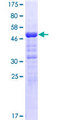ANKRD49 Protein - 12.5% SDS-PAGE of human ANKRD49 stained with Coomassie Blue