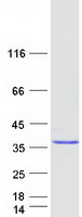 ANKRD49 Protein - Purified recombinant protein ANKRD49 was analyzed by SDS-PAGE gel and Coomassie Blue Staining