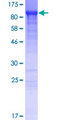 ANKRD50 Protein - 12.5% SDS-PAGE of human ANKRD50 stained with Coomassie Blue