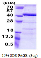 ANKRD54 / LIAR Protein