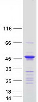 ANKRD63 Protein - Purified recombinant protein ANKRD63 was analyzed by SDS-PAGE gel and Coomassie Blue Staining