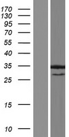 ANKRD7 Protein - Western validation with an anti-DDK antibody * L: Control HEK293 lysate R: Over-expression lysate