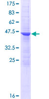 ANKRD7 Protein - 12.5% SDS-PAGE of human ANKRD7 stained with Coomassie Blue