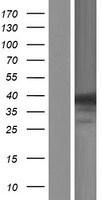 ANKRD9 Protein - Western validation with an anti-DDK antibody * L: Control HEK293 lysate R: Over-expression lysate