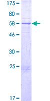 ANKRD9 Protein - 12.5% SDS-PAGE of human ANKRD9 stained with Coomassie Blue