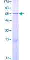 ANKRD9 Protein - 12.5% SDS-PAGE of human ANKRD9 stained with Coomassie Blue