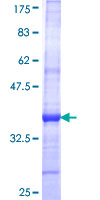 ANKS1A / ODIN Protein - 12.5% SDS-PAGE Stained with Coomassie Blue.