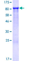 ANKS3 Protein - 12.5% SDS-PAGE of human ANKS3 stained with Coomassie Blue