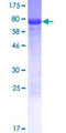 ANKS4B Protein - 12.5% SDS-PAGE of human ANKS4B stained with Coomassie Blue