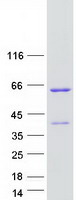 ANKS4B Protein - Purified recombinant protein ANKS4B was analyzed by SDS-PAGE gel and Coomassie Blue Staining