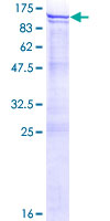 ANKZF1 Protein - 12.5% SDS-PAGE of human ANKZF1 stained with Coomassie Blue