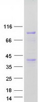 ANKZF1 Protein - Purified recombinant protein ANKZF1 was analyzed by SDS-PAGE gel and Coomassie Blue Staining