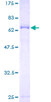 ANO10 / TMEM16K Protein - 12.5% SDS-PAGE of human FLJ10375 stained with Coomassie Blue