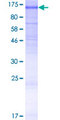 ANO6 Protein - 12.5% SDS-PAGE of human TMEM16F stained with Coomassie Blue