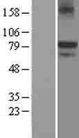 ANOS1 / Anosmin Protein - Western validation with an anti-DDK antibody * L: Control HEK293 lysate R: Over-expression lysate
