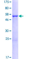 ANP32B Protein - 12.5% SDS-PAGE of human ANP32B stained with Coomassie Blue