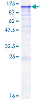 ANPEP / CD13 Protein - 12.5% SDS-PAGE of human ANPEP stained with Coomassie Blue