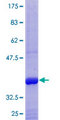ANPEP / CD13 Protein - 12.5% SDS-PAGE Stained with Coomassie Blue.