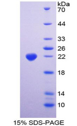 ANPEP / CD13 Protein - Recombinant  Alanine Aminopeptidase By SDS-PAGE