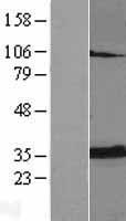 ANT2 / SLC25A5 Protein - Western validation with an anti-DDK antibody * L: Control HEK293 lysate R: Over-expression lysate