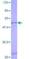 ANT2 / SLC25A5 Protein - 12.5% SDS-PAGE of human SLC25A5 stained with Coomassie Blue