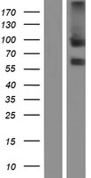 ANTXR1 / TEM8 Protein - Western validation with an anti-DDK antibody * L: Control HEK293 lysate R: Over-expression lysate
