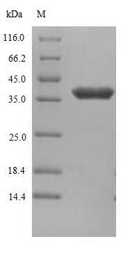 ANTXR1 / TEM8 Protein - (Tris-Glycine gel) Discontinuous SDS-PAGE (reduced) with 5% enrichment gel and 15% separation gel.