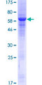 ANTXR1 / TEM8 Protein - 12.5% SDS-PAGE of human ANTXR1 stained with Coomassie Blue