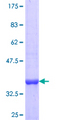 ANTXR1 / TEM8 Protein - 12.5% SDS-PAGE Stained with Coomassie Blue.