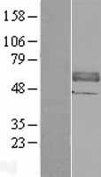 ANTXR2 / CMG2 Protein - Western validation with an anti-DDK antibody * L: Control HEK293 lysate R: Over-expression lysate