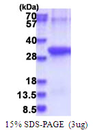 ANTXR2 / CMG2 Protein