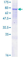 ANTXR2 / CMG2 Protein - 12.5% SDS-PAGE of human ANTXR2 stained with Coomassie Blue