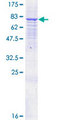 ANTXR2 / CMG2 Protein - 12.5% SDS-PAGE of human ANTXR2 stained with Coomassie Blue