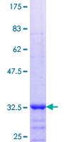 ANTXR2 / CMG2 Protein - 12.5% SDS-PAGE Stained with Coomassie Blue.