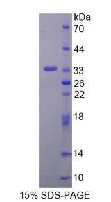 ANTXR2 / CMG2 Protein - Recombinant Anthrax Toxin Receptor 2 By SDS-PAGE