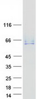 ANTXR2 / CMG2 Protein - Purified recombinant protein ANTXR2 was analyzed by SDS-PAGE gel and Coomassie Blue Staining