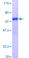 ANXA1 / Annexin A1 Protein - 12.5% SDS-PAGE of human ANXA1 stained with Coomassie Blue