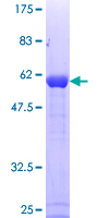 ANXA1 / Annexin A1 Protein - 12.5% SDS-PAGE of human ANXA1 stained with Coomassie Blue